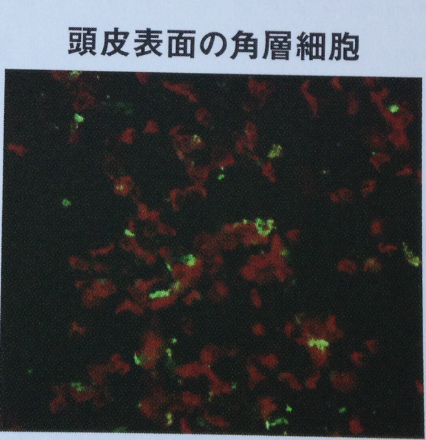 頭皮表面の角質細胞画像