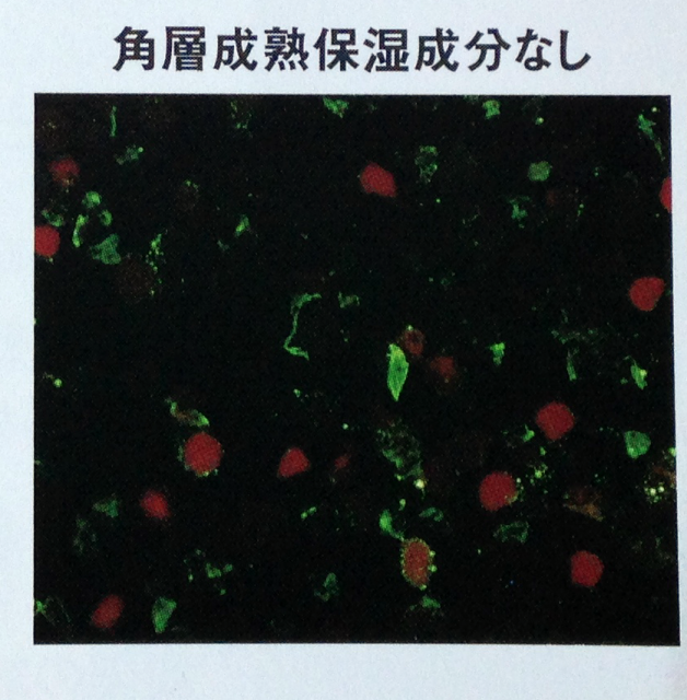 角質細胞保湿成分なし 画像