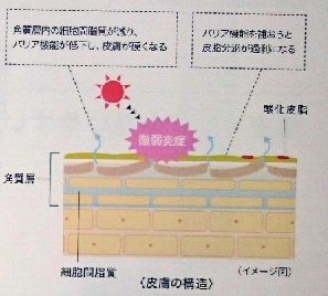 皮膚の構造画像