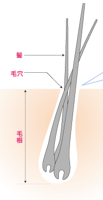 クセ毛のタイプと特長画像